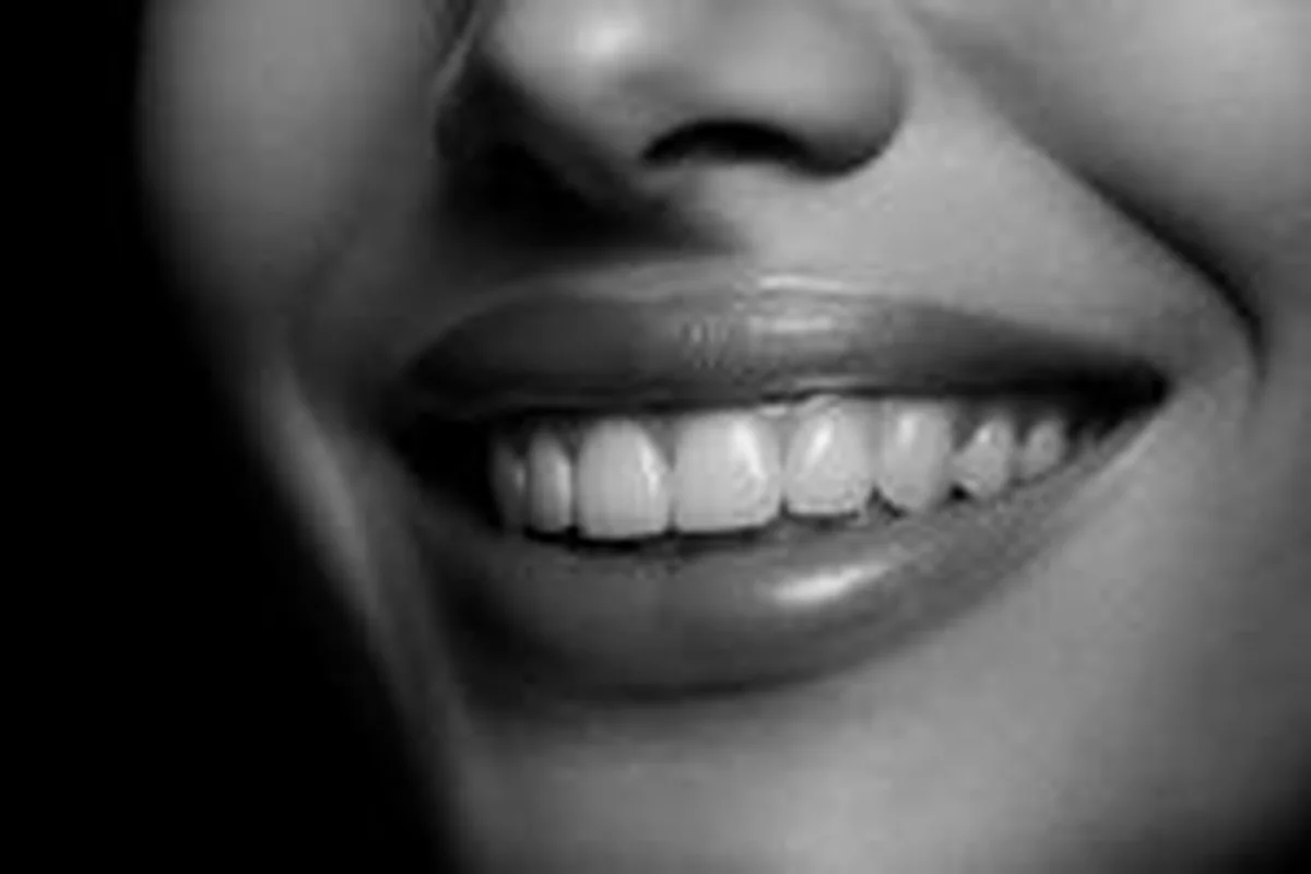 Gummy Smile Botox – Dr. Martin Kraft Wien