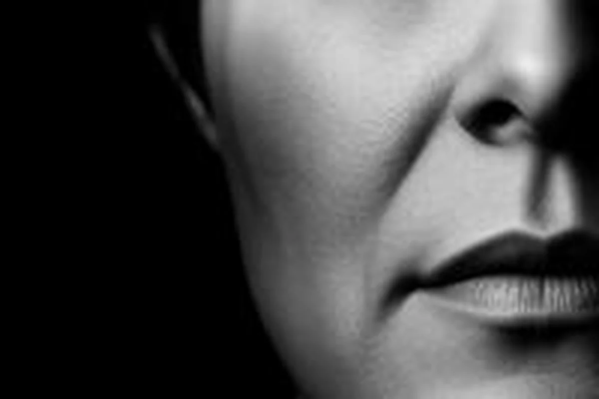 Nasolabialfalten Filler – Dr. Martin Kraft Wien