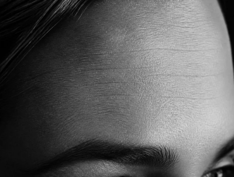 Vorbereitung zur Botox Behandlung