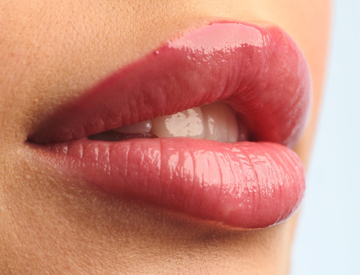 lippen aufspritzen