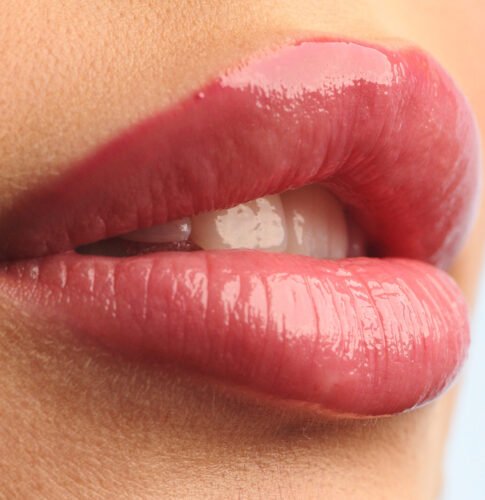 lippen aufspritzen