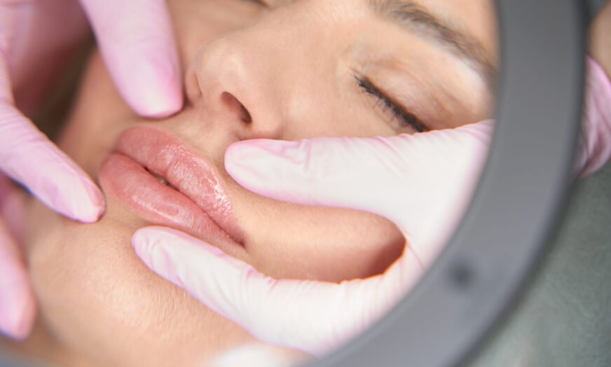 lippen aufspritzen